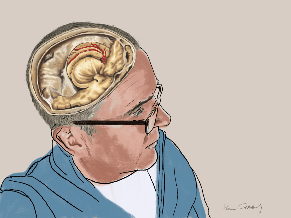 The hard problem of&nbsp;Paul